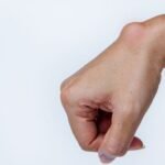 Can Urgent Care Drain a Cyst