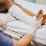 Broken Bone or Bad Bruise