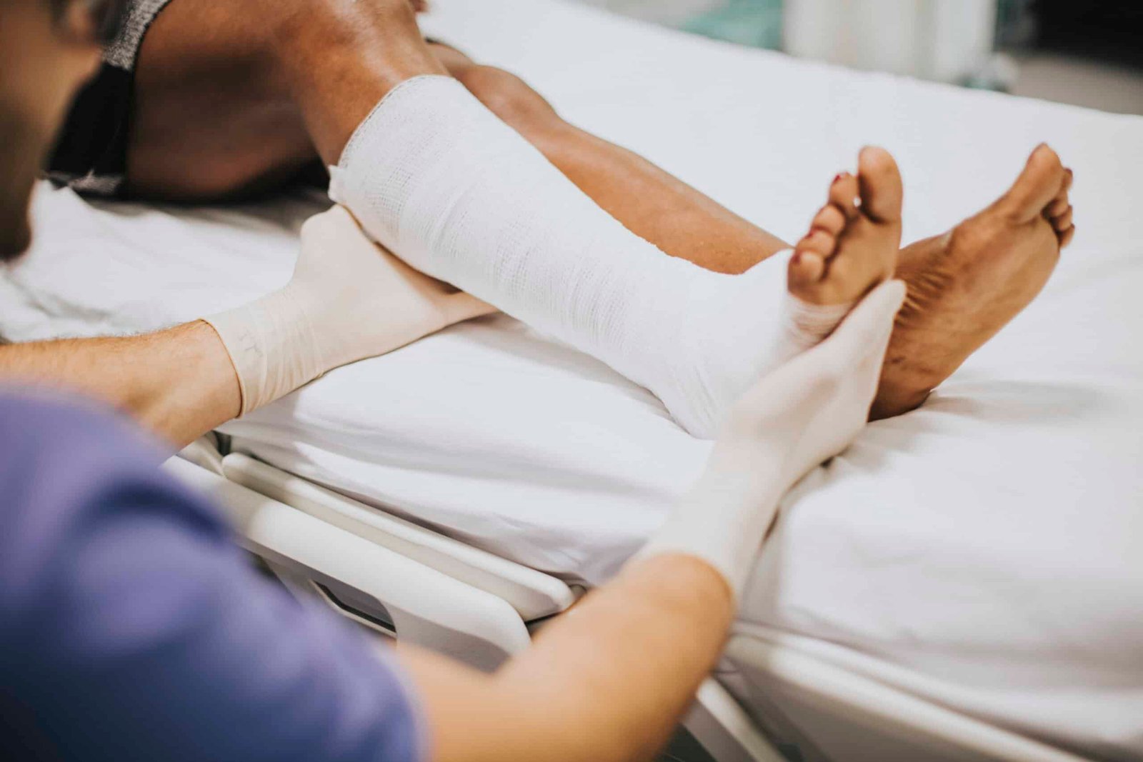 Broken Bone or Bad Bruise